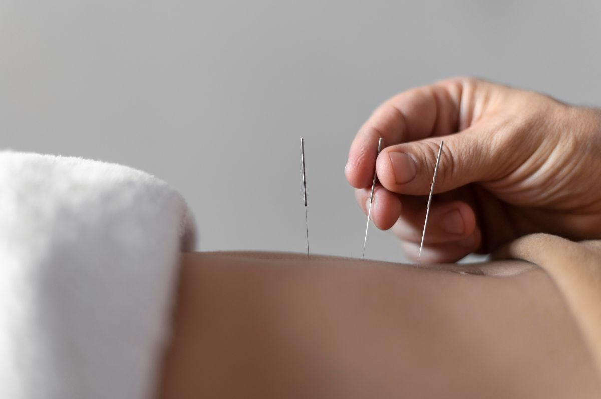 Akupunktúra, mint természetes pajzsmirigykezelés - freepik